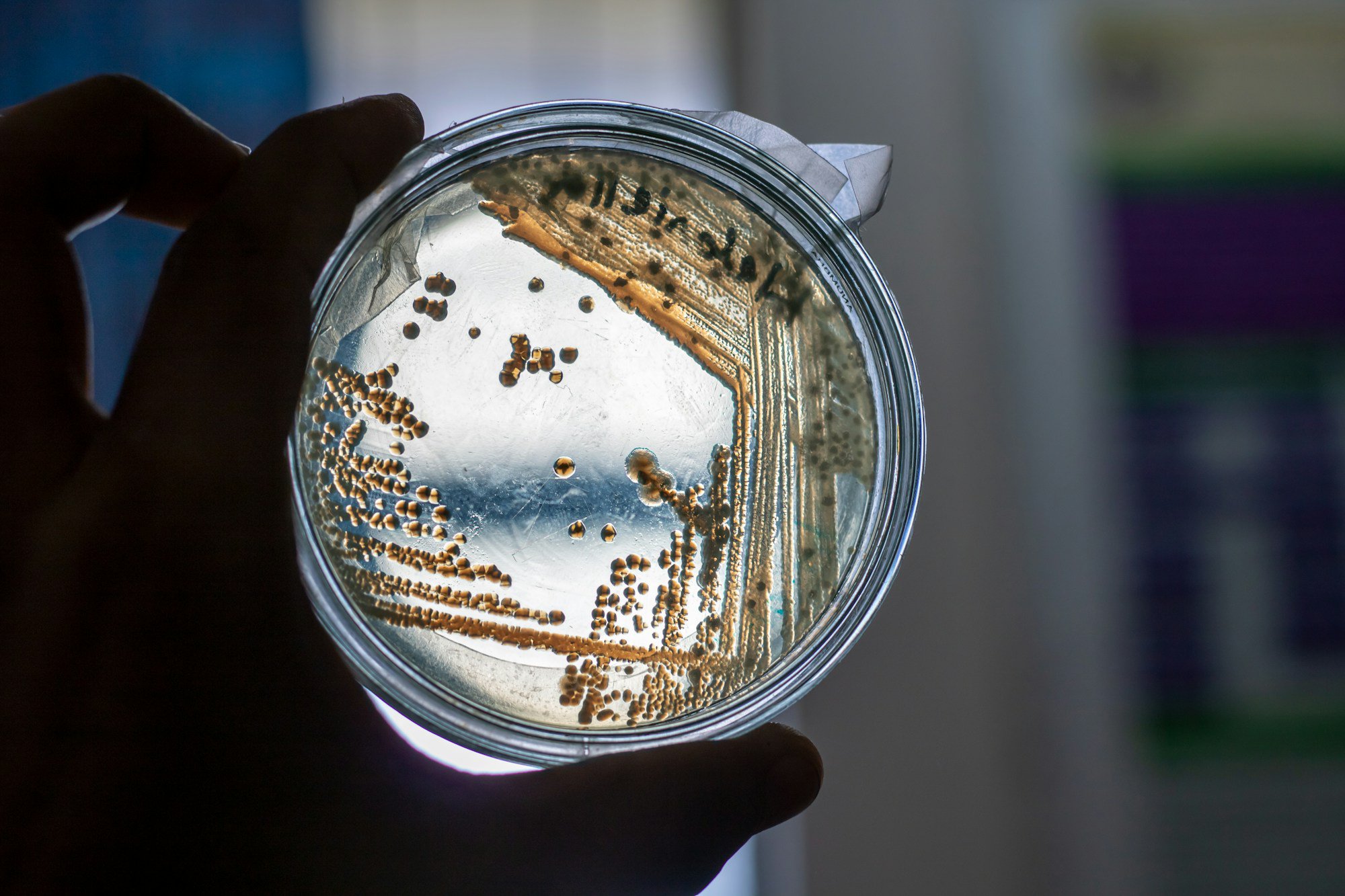 A petri dish with bacteria cultures.