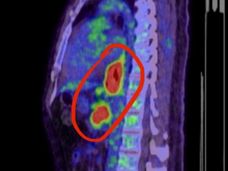 If I Were Diagnosed With Cancer Today - Here's Exactly What I'd Do cover
